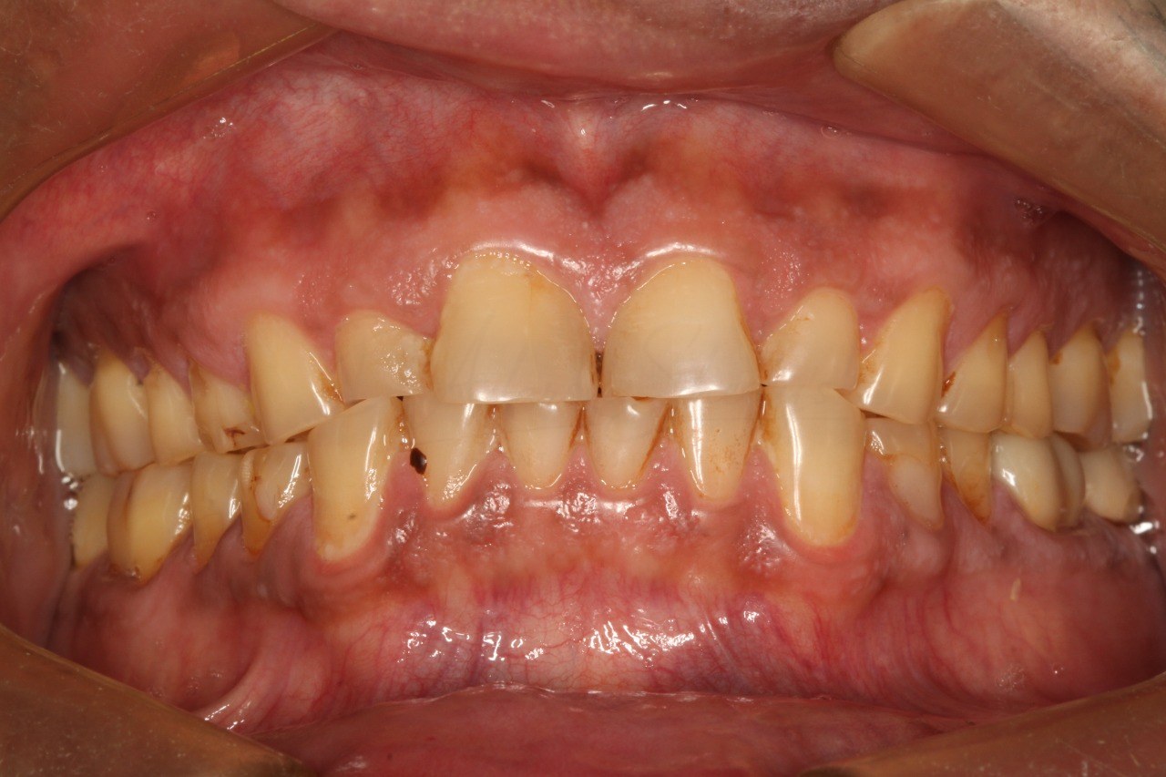 FMR Case 4 Before