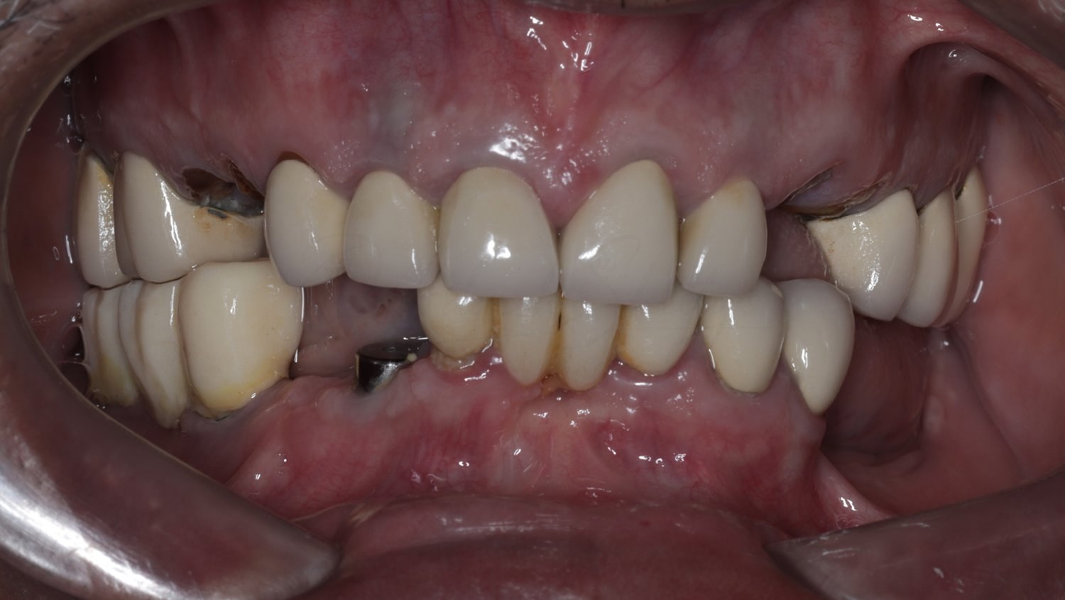 FMR Case 5 Before