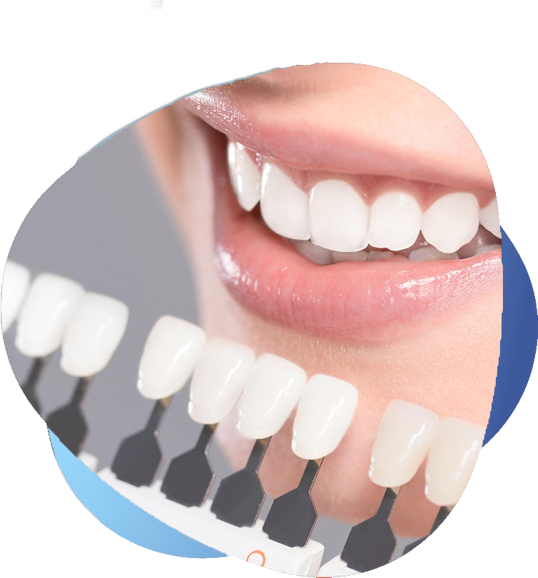 Cosmetic Dentistry Shade Matching