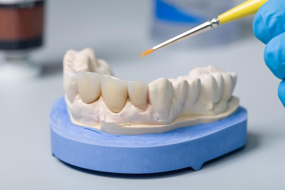 Minimally Invasive Dental Diagnostics and 3D Planning