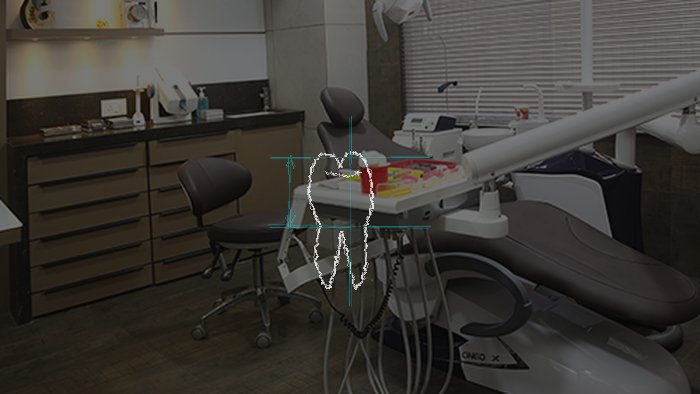 Digital Smile Analysis